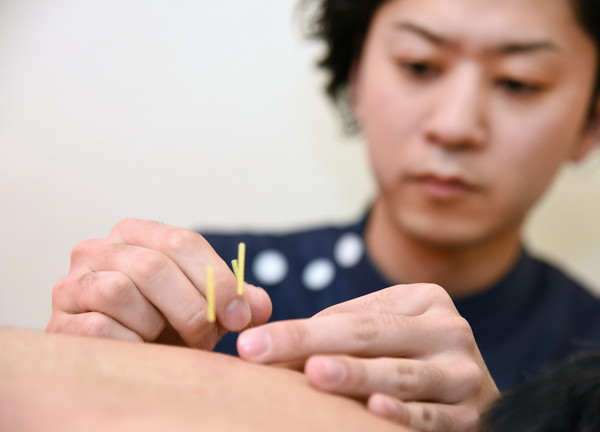つきぐま鍼灸整骨院（有限会社介正）　施術2